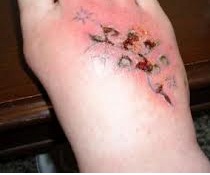 Tattoo Infection Signs and Symptoms