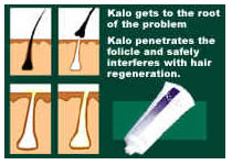 kalo-root-1-.jpg